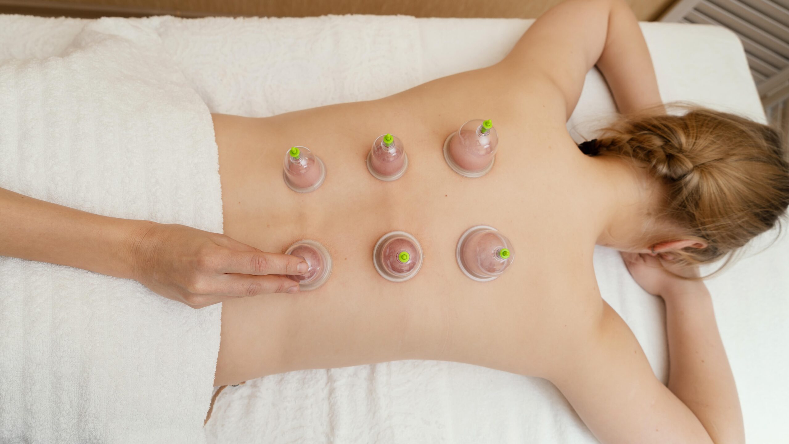 cupping-therapy 2