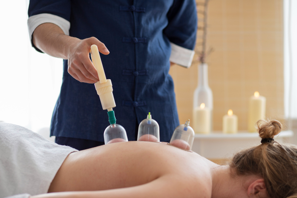 cupping-therapy 3